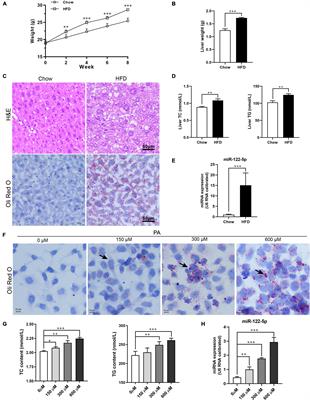 MicroRNA-122-5p Inhibition Improves Inflammation and Oxidative Stress Damage in Dietary-Induced Non-alcoholic Fatty Liver Disease Through Targeting FOXO3